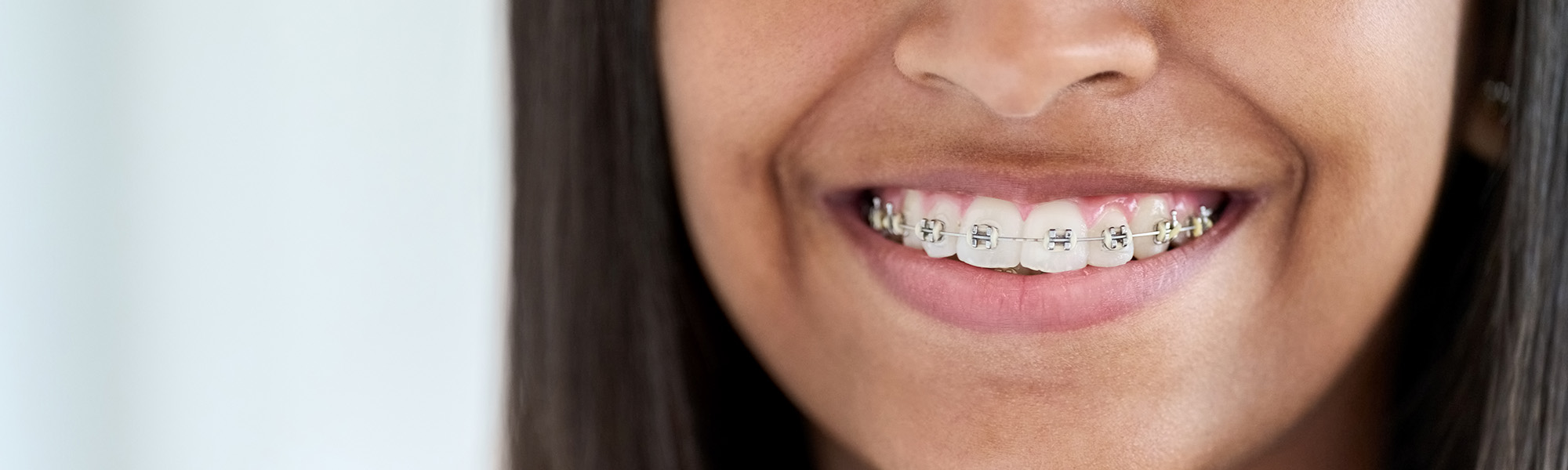 Holiday Treats You Can Enjoy With Braces