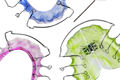 Long-Term Retainer Care: How to Avoid Surprises Years Later