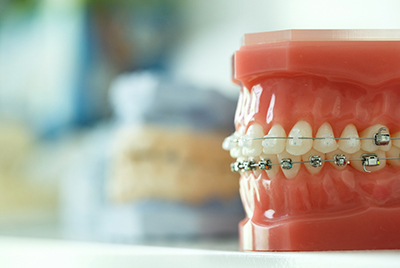 Blog Post Thumbnail Image