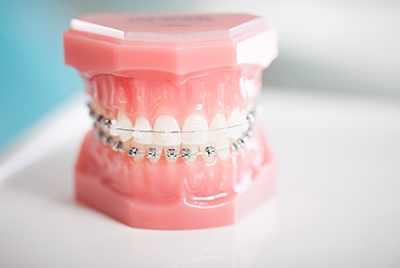 Blog Post Thumbnail Image