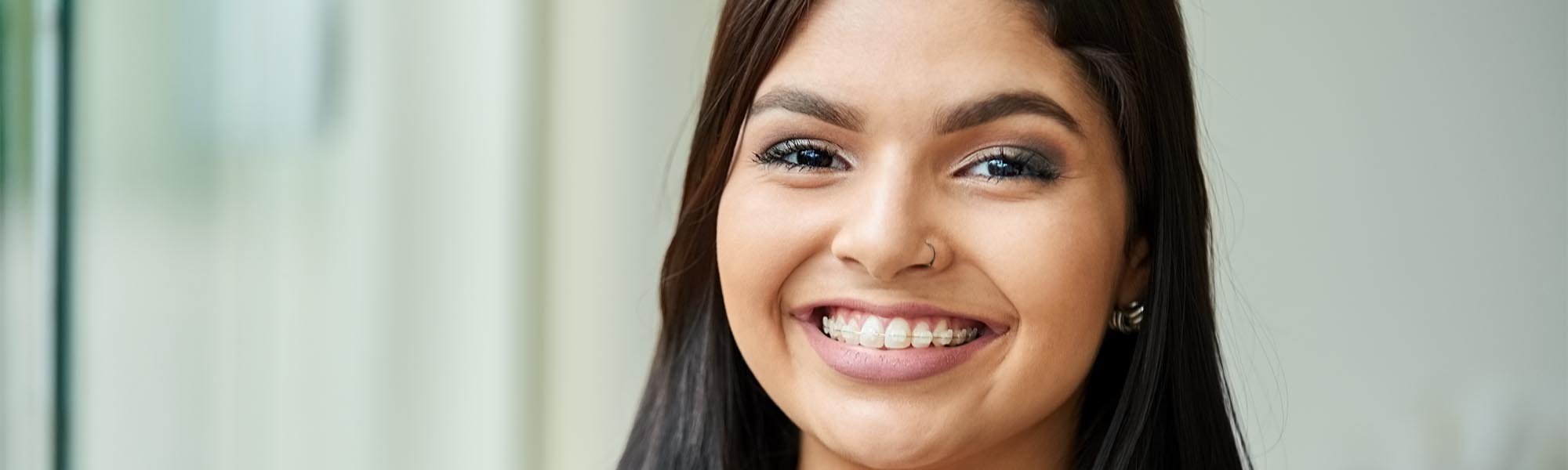 Ceramic Braces Long Beach CA