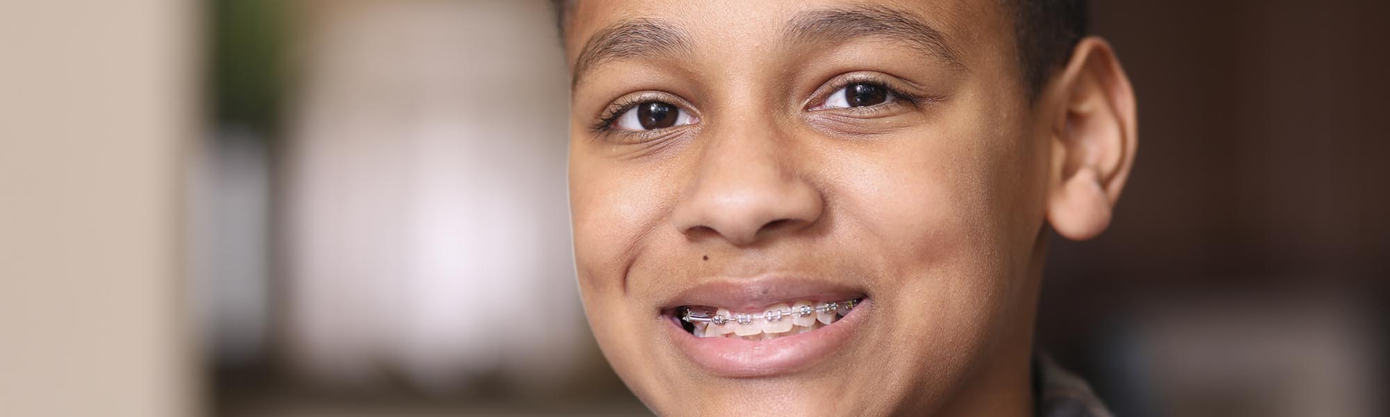 Why Straighten Teeth at Orthodontics of Long Beach Blog Banner