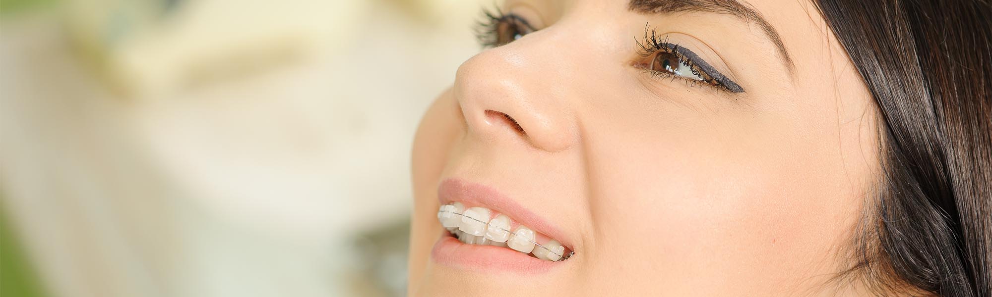 Ceramic Braces Long Beach CA